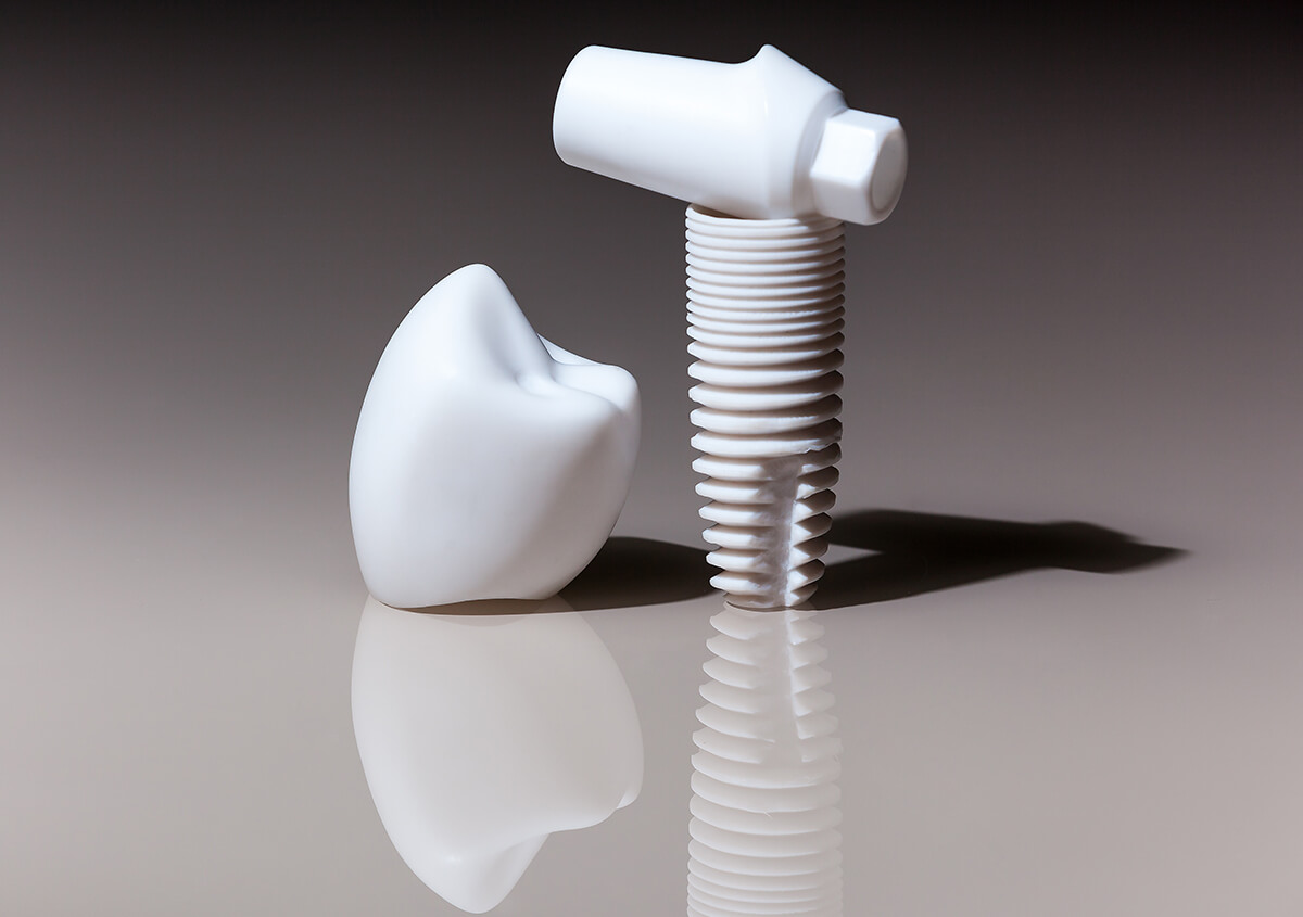 Ceramic Dental Implants, a novel concept for replacing lost teeth